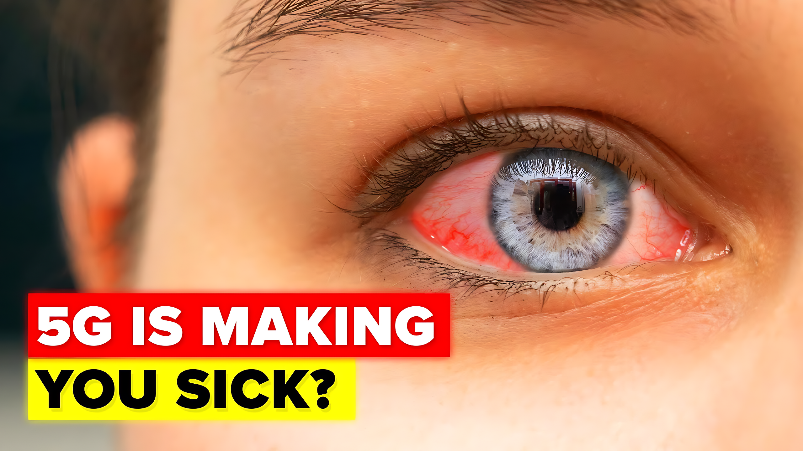 Proof that 5G is going to make us all sick?