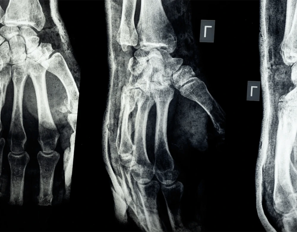Dealing with an unexpected injury