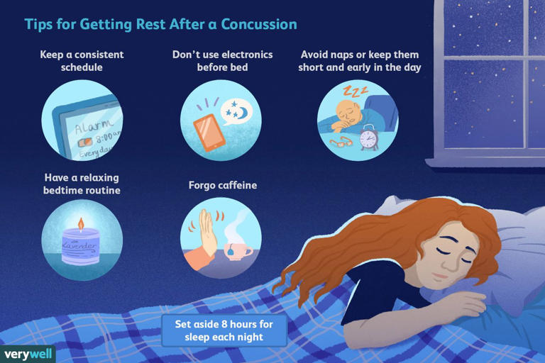 Is it safe to sleep after a concussion?