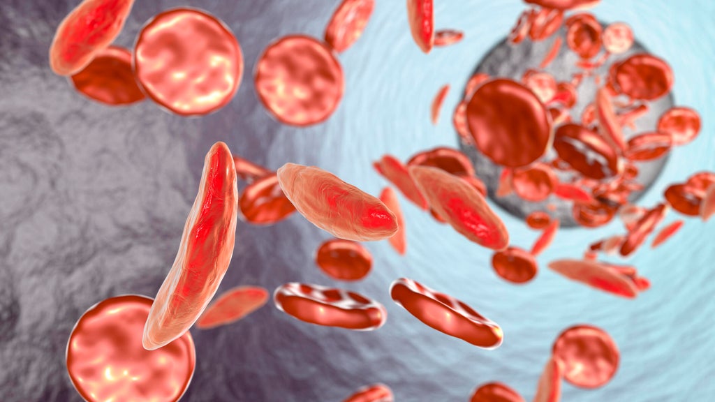 South Florida teen among first to receive gene therapy to treat sickle ...