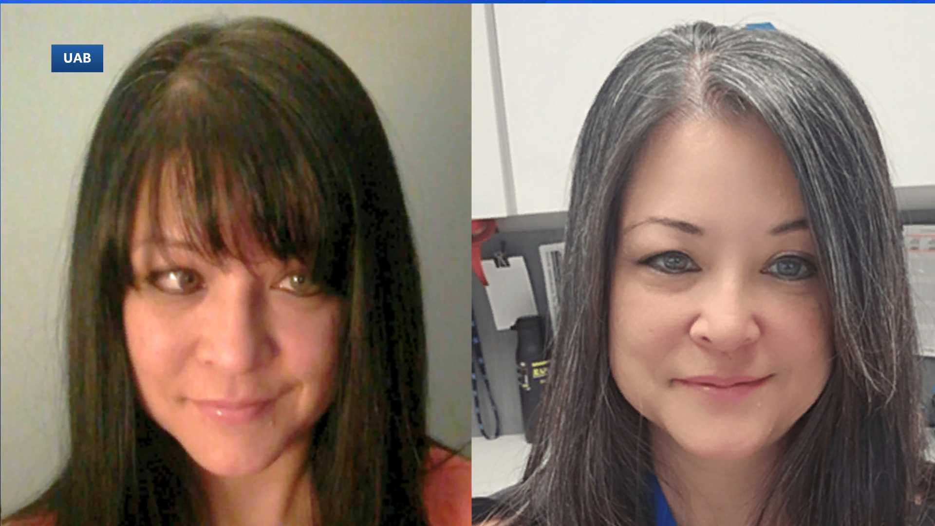 UAB Hospital-Callahan Eye patient regains confidence after rare surgery