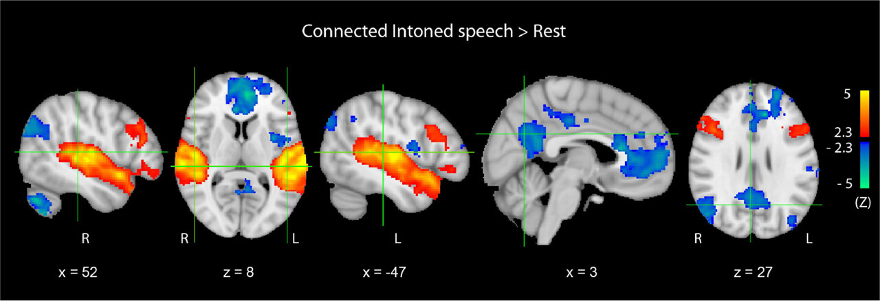 How the brain dynamically reconfigures networks during speech processing