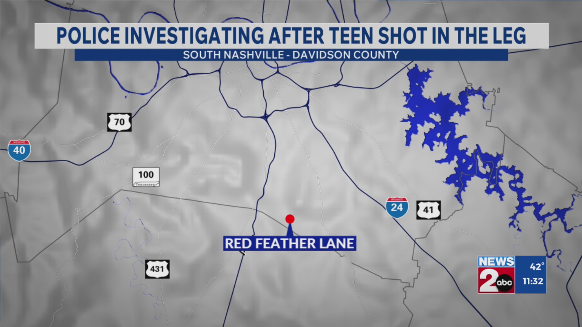 Police share update after teen shot in leg