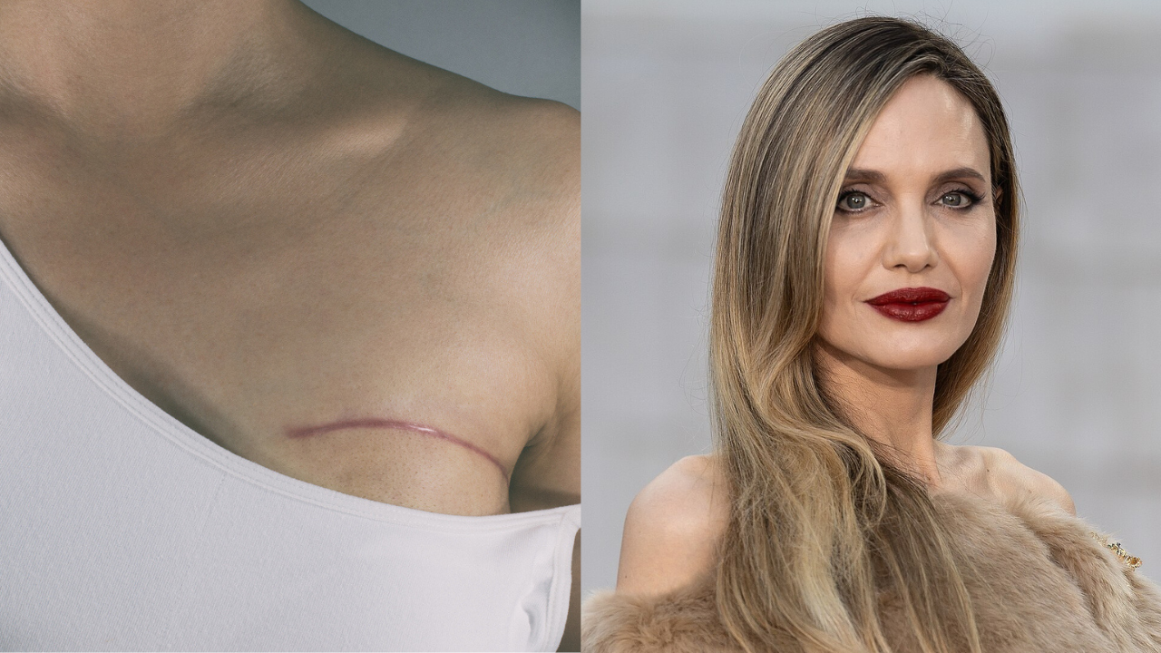 Angelina Jolie shows her mastectomy scars, turns survival, choice, and
