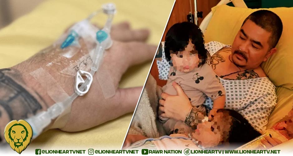 Pambansang Kolokoy reveals battle with cancer, undergoing second cycle of  chemotherapy