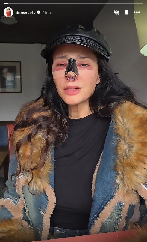 La modelo y actriz Dorismar comparte momento tras someterse a una cirugía luego de sufrir una mala praxis.