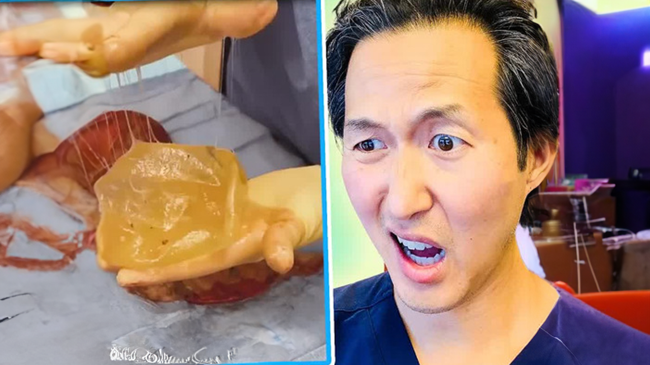 Doctor reviews viral skincare and surgery TikToks