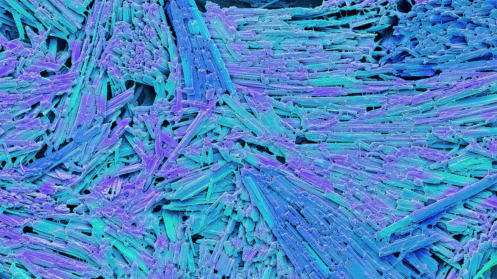 Gout and its comorbidities