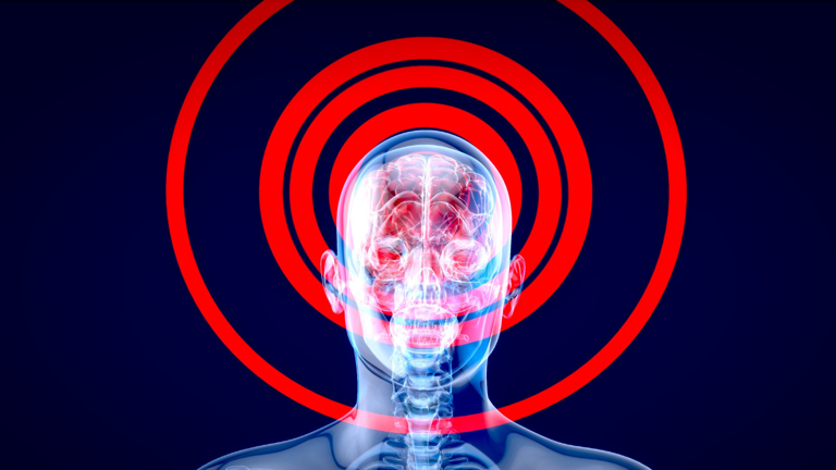 What are ‘brain zaps’ and should they worry you?