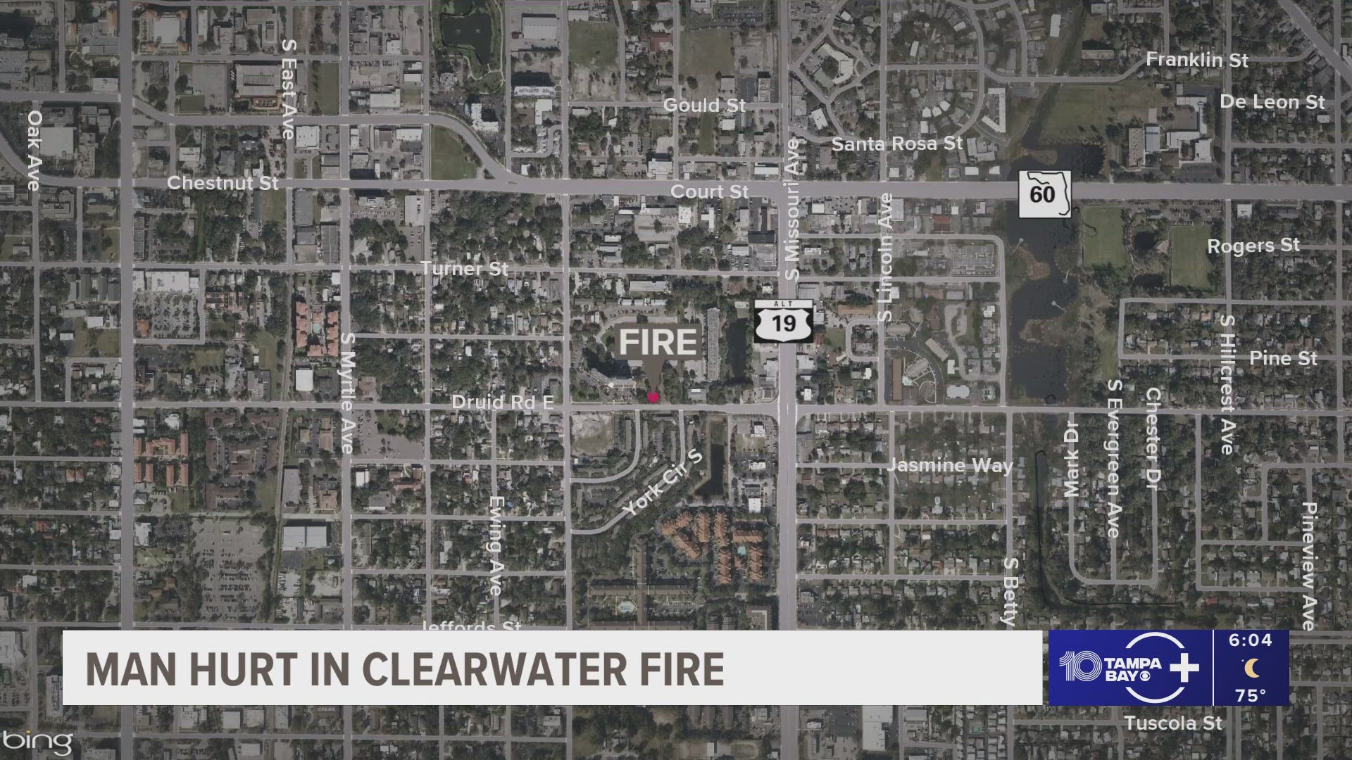 Clearwater man experiencing homelessness hospitalized due to serious burns