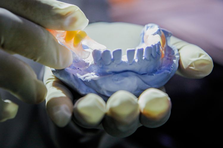 Mengenal Penyebab dan Solusi Gigi Ompong pada Dewasa