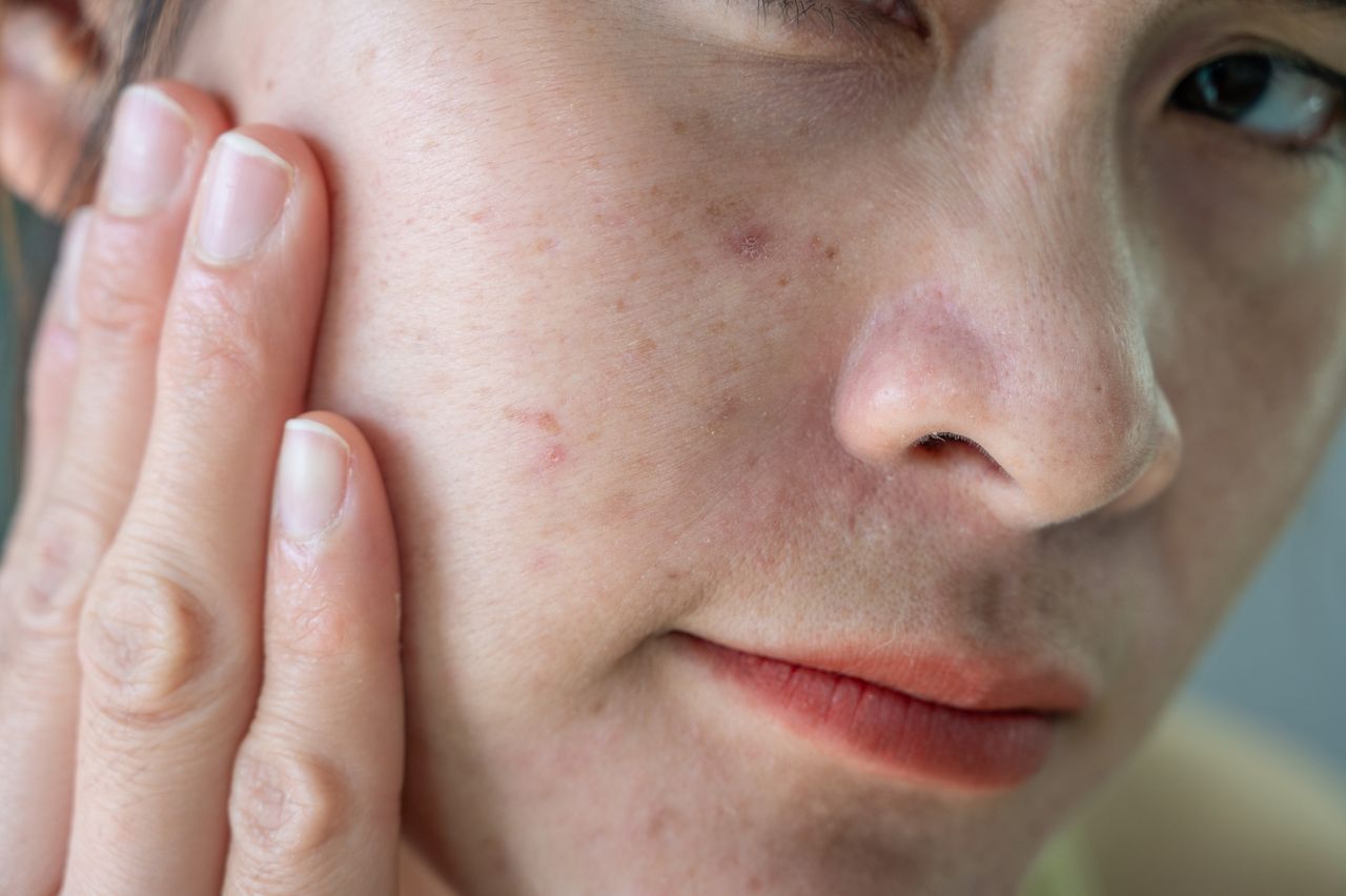 13 dermatologist-approved tips to improve skin texture