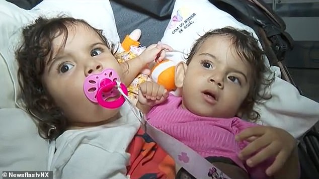 Siamese twins Kiraz (left) and Aruna (right), aged 1 8 months