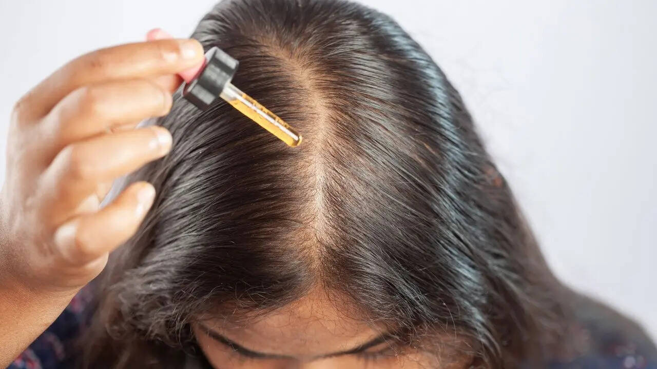 Minoxidil use by mothers linked to potential health risks in infants