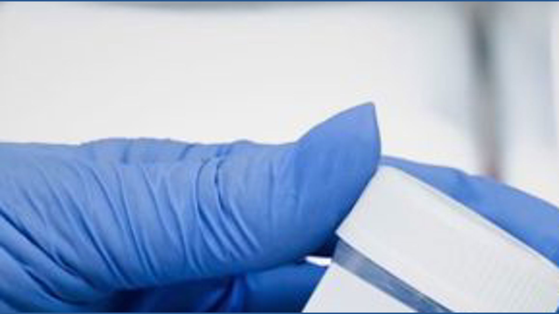 American Cancer Society approves new at-home test for HPV