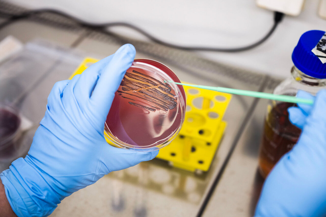 New toothpaste stops periodontal pathogens