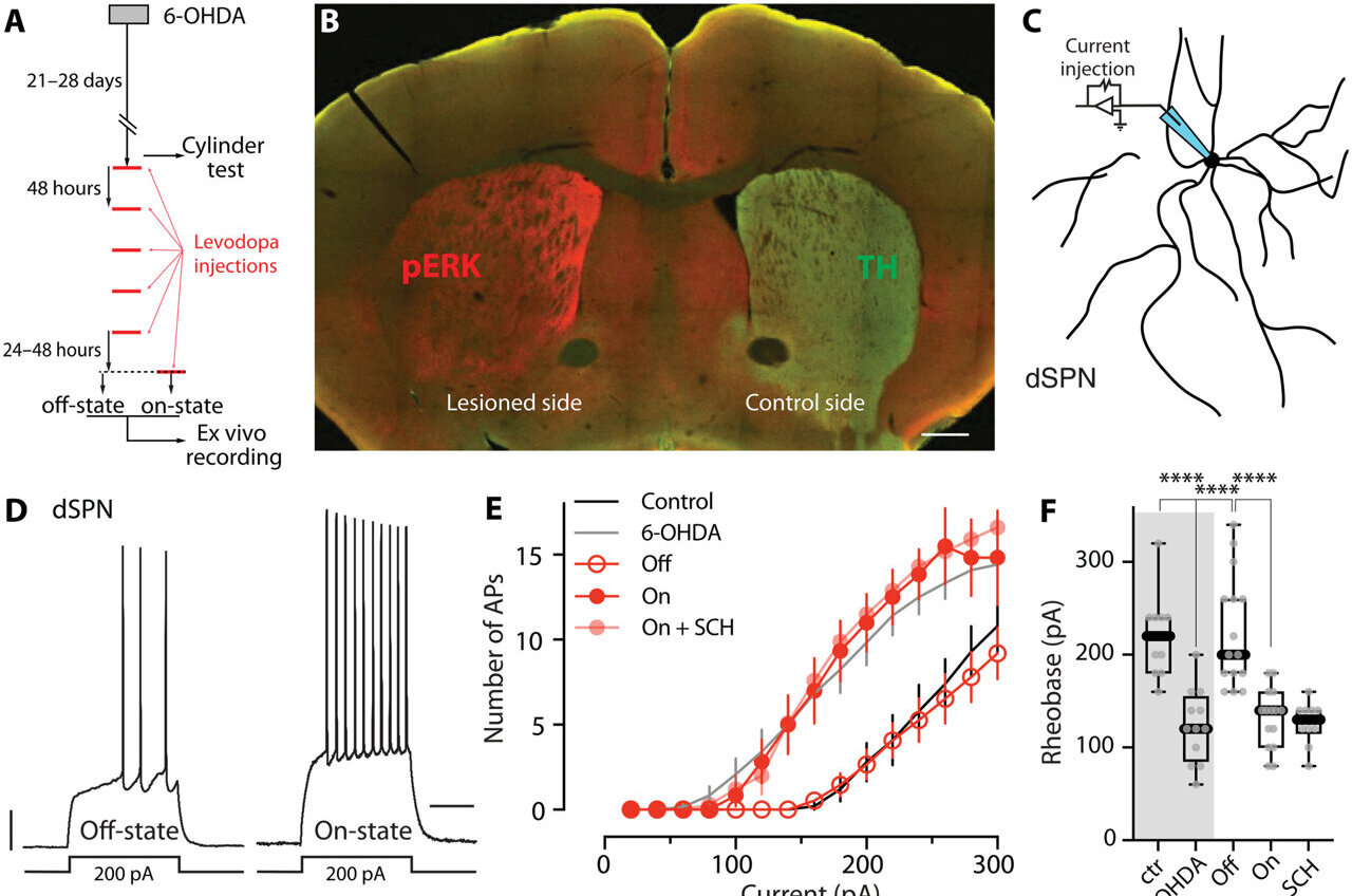 Targeting aberrant learning may improve Parkinson's treatment