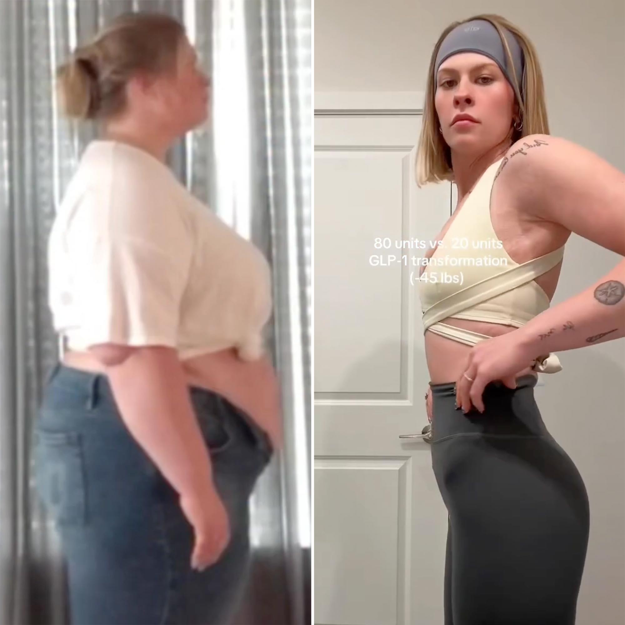Influencer Samantha Milton talks 260-lb weight loss using GLP-1