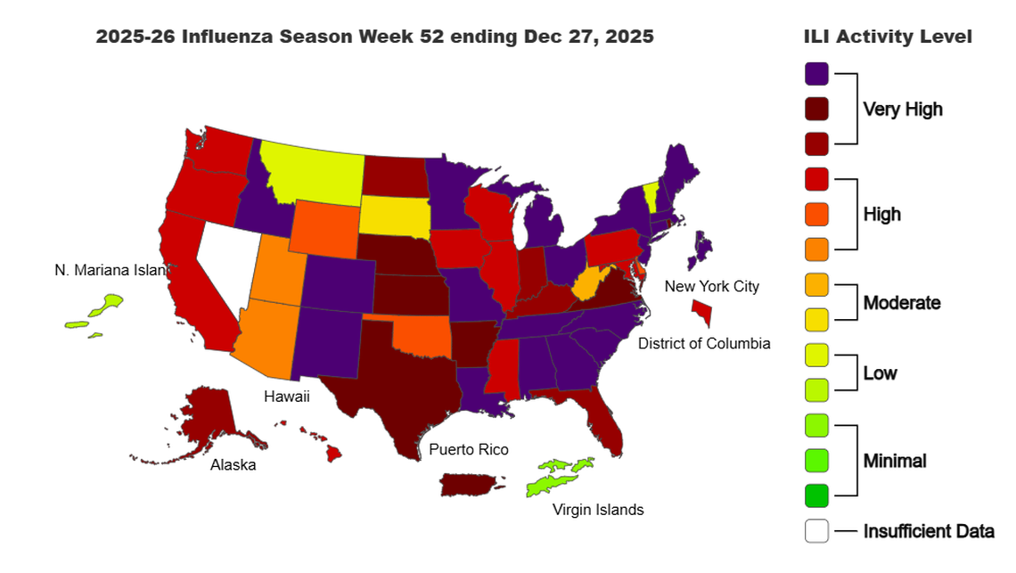 AA1TG5aq Flu Surges in Tri-Cities: New Records Set Amid Rising Cases