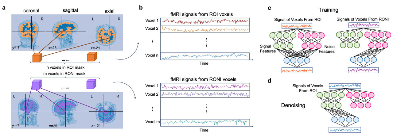AI gives a clearer picture of functional MRI brain data