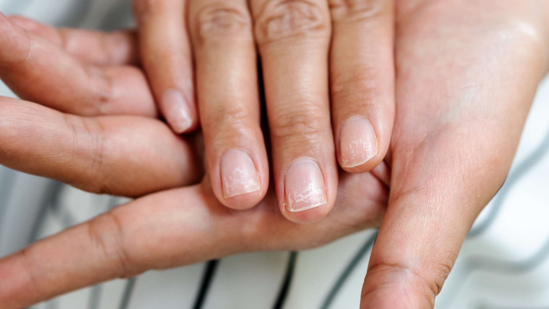 Nail changes you should never ignore