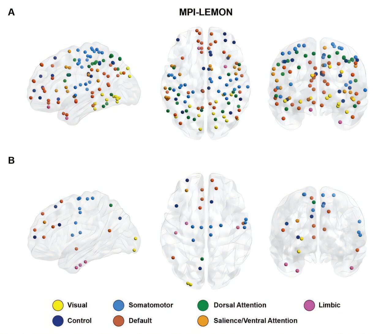 Mathematics uncovers shifting brain connectivity in autism and aging