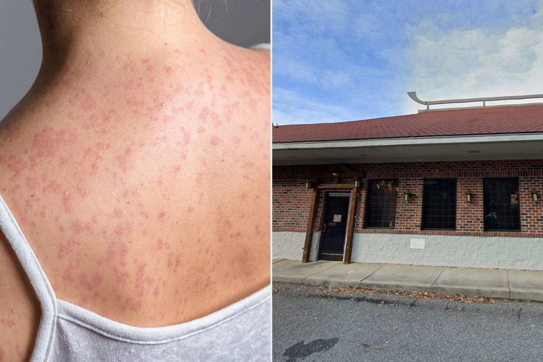 Health officials alert diners to possible measles exposure after ...