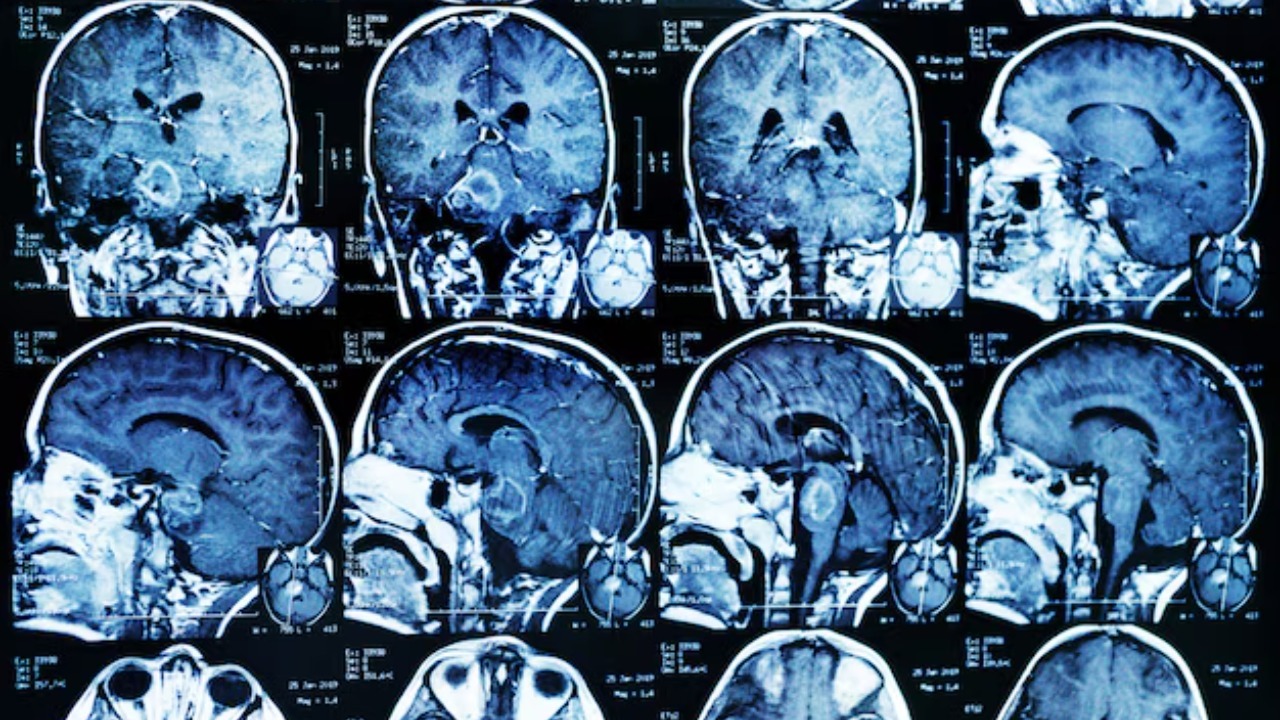 Why some brains run faster than others, according to Rutgers