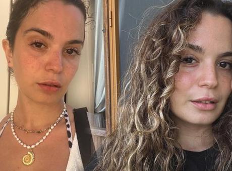 'Bağırsağımı yanlışlıkla kestiler' demişti! Aslı Bekiroğlu hastaneden son halini paylaştı