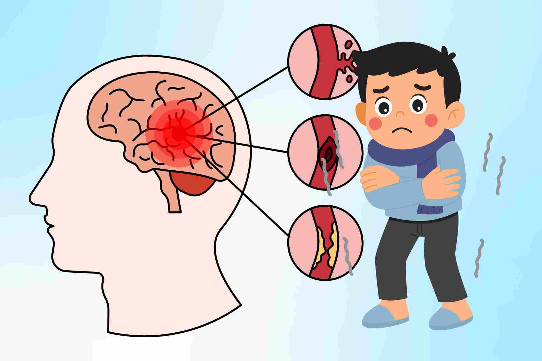 3 thời điểm mùa lạnh dễ kích hoạt đột quỵ nhiều người không biết