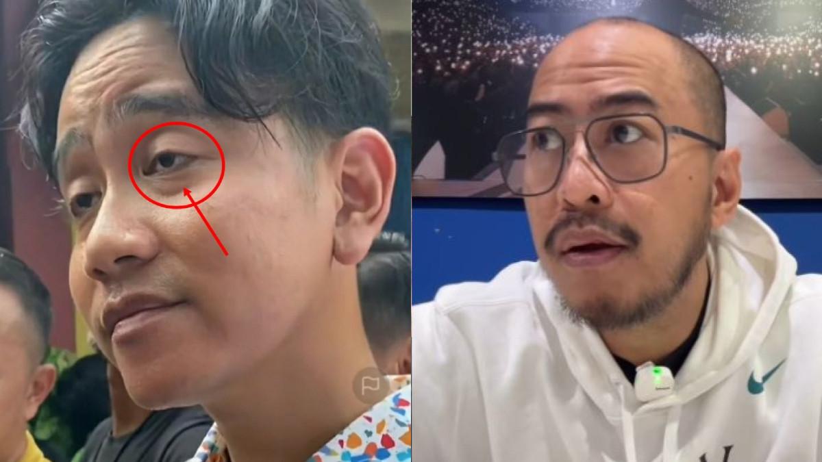 EFEK MENS REA - Mata Wapres Gibran yang terlihat sayu dan ngantuk dijadikan materi komedi Pandji Pragiwaksono. Apa itu Ptosis? (Kolase TribunTrends/Istimewa)