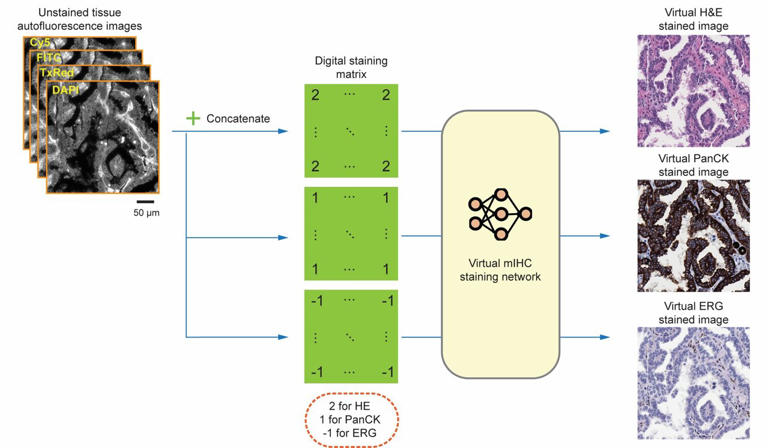 Deep learning creates virtual multiplexed immunostaining to improve ...