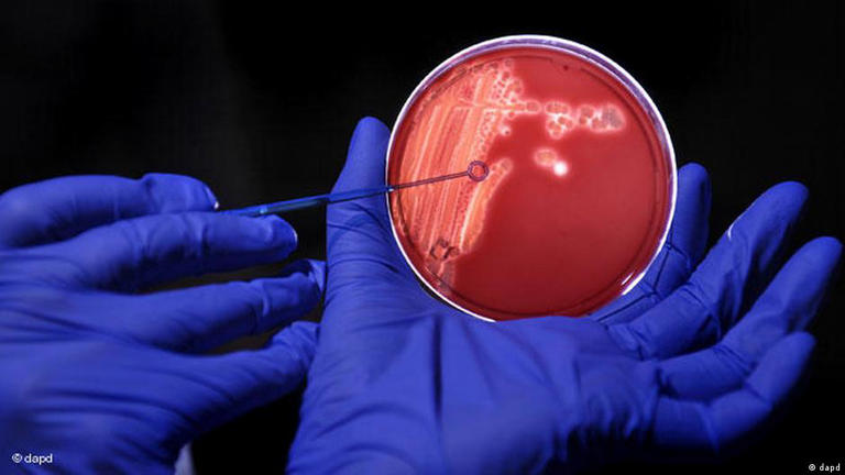 كشفت دراسة حديثة ارتباط بكتيريا معوية شائعة تسبب تسوس الأسنان بمرض باركنسون العصبي.