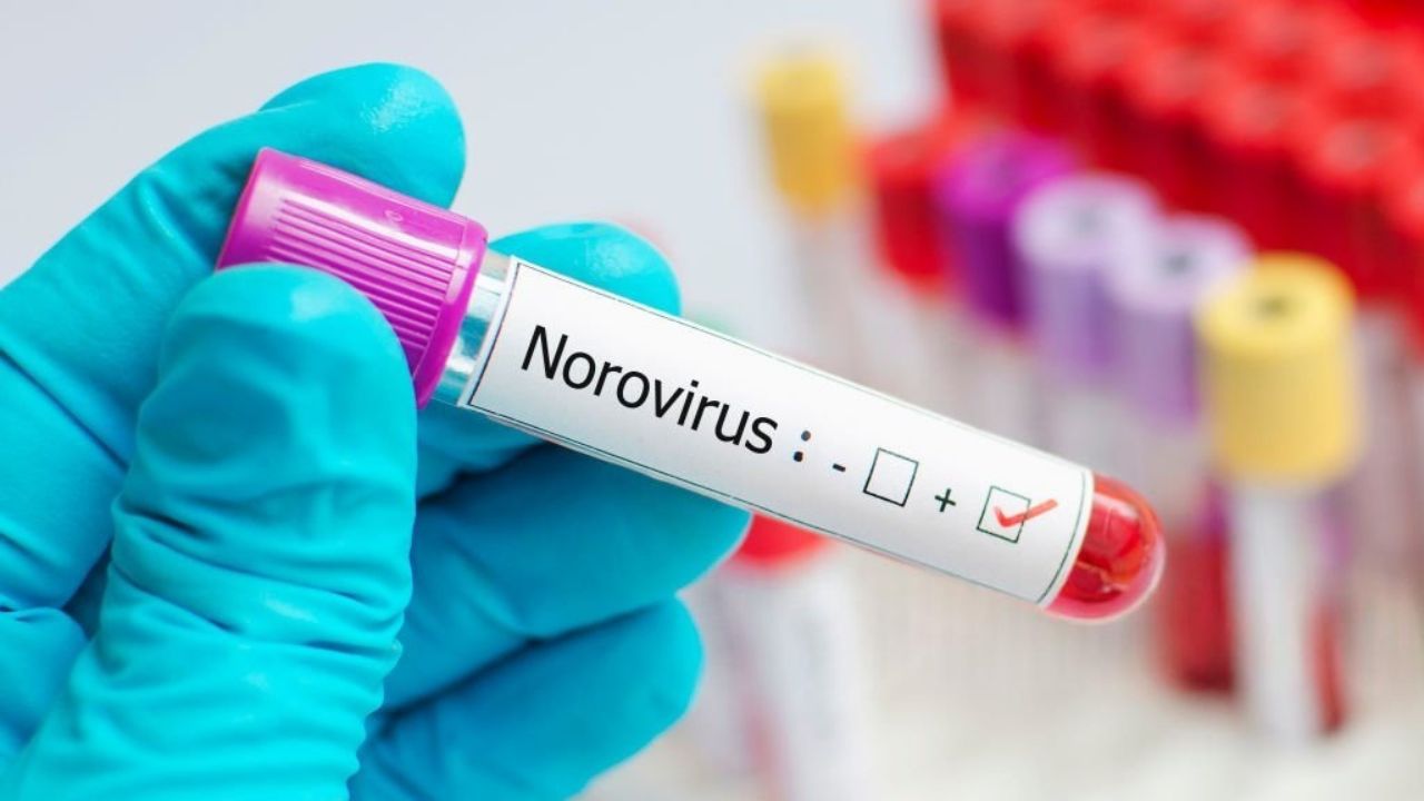 Norovirus outbreaks are being tracked this season, and your cleaning ...