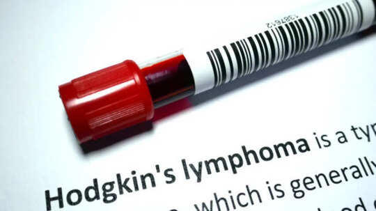 4 types of cancer that may cause persistent itching symptoms
