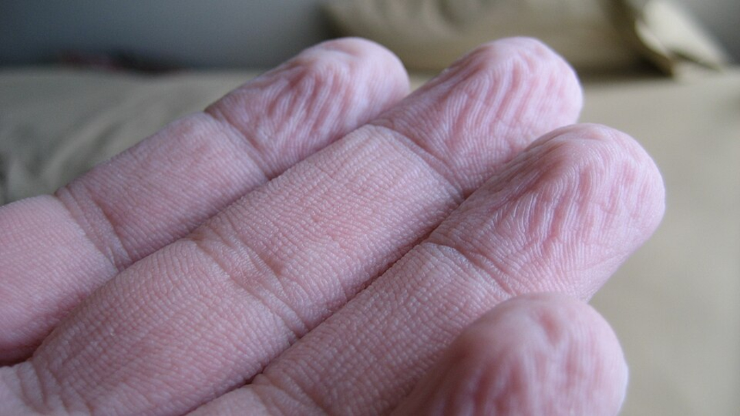 16. Why do our fingers prune in the water?