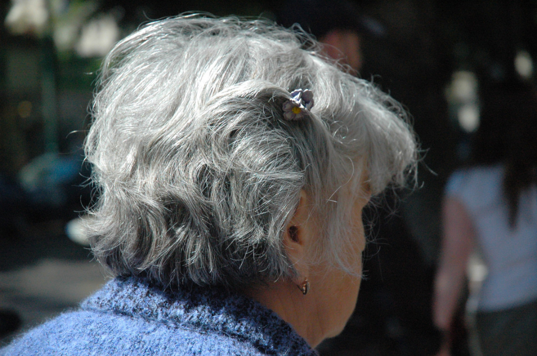 20. Why does hair turn grey?