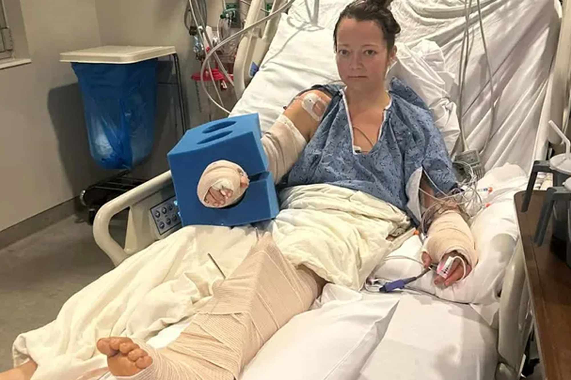 Mom attacked by pet dog at home, with injury that left her leg 'hanging ...