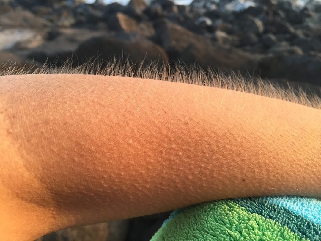 2. Why do we get goosebumps?