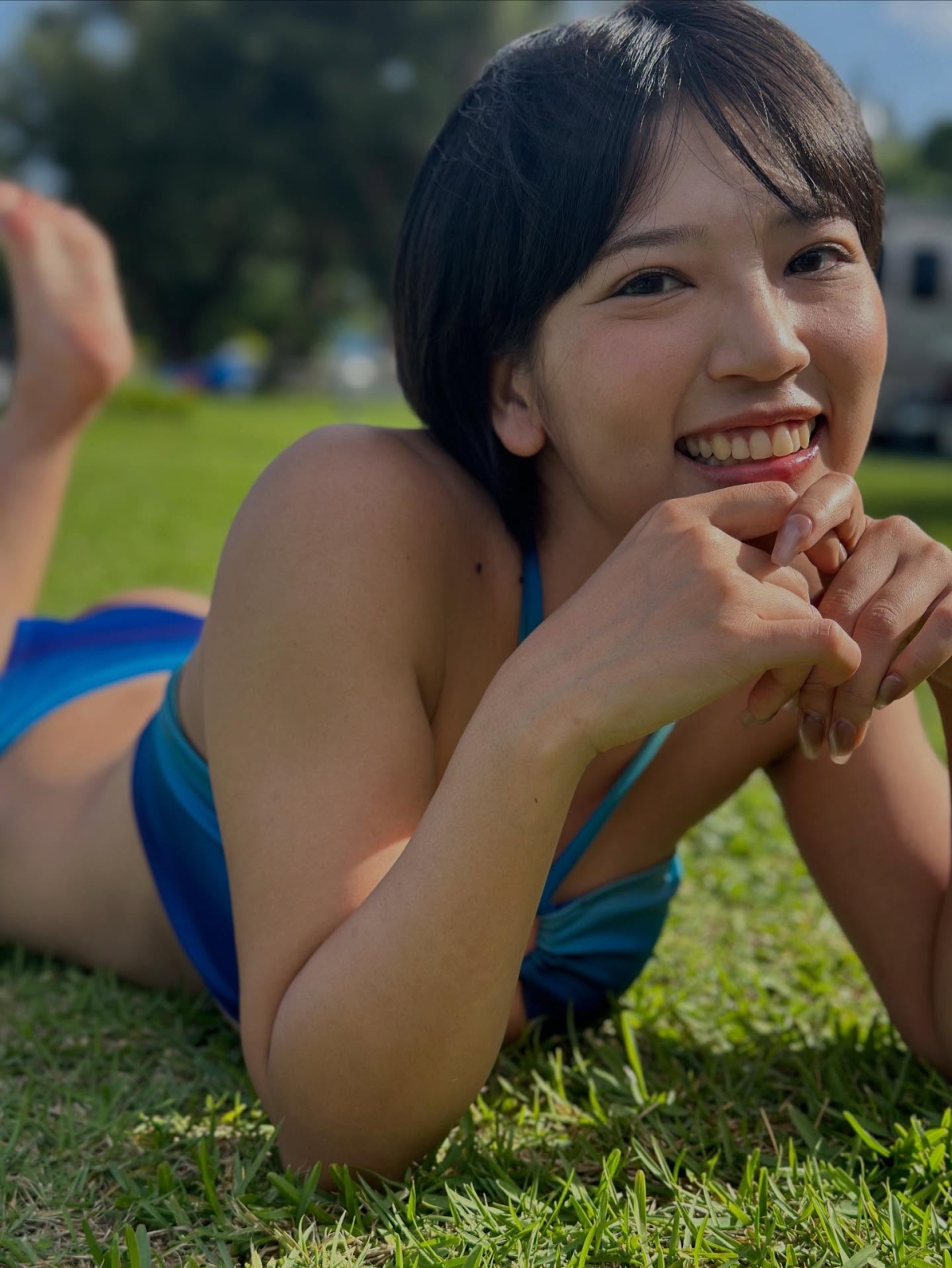 Người mẫu áo tắm qua đời ở tuổi 27