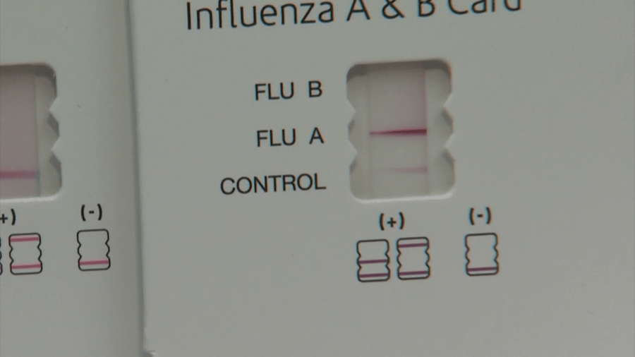 Pediatric flu cases surge 80% in one week, hospital reports