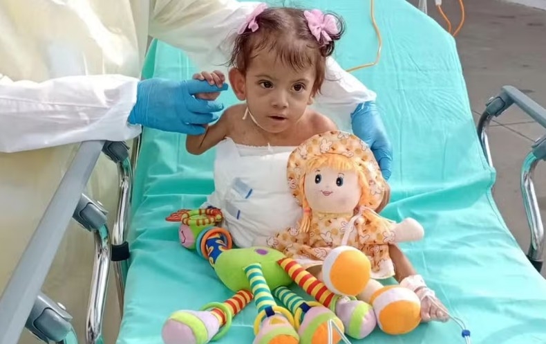 Bé song sinh dính liền qua đời sau 7 tháng được phẫu thuật tách rời