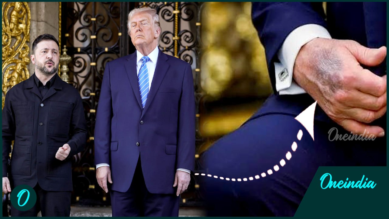 Trump’s health under scrutiny after photos show bruised hands, bandages ...