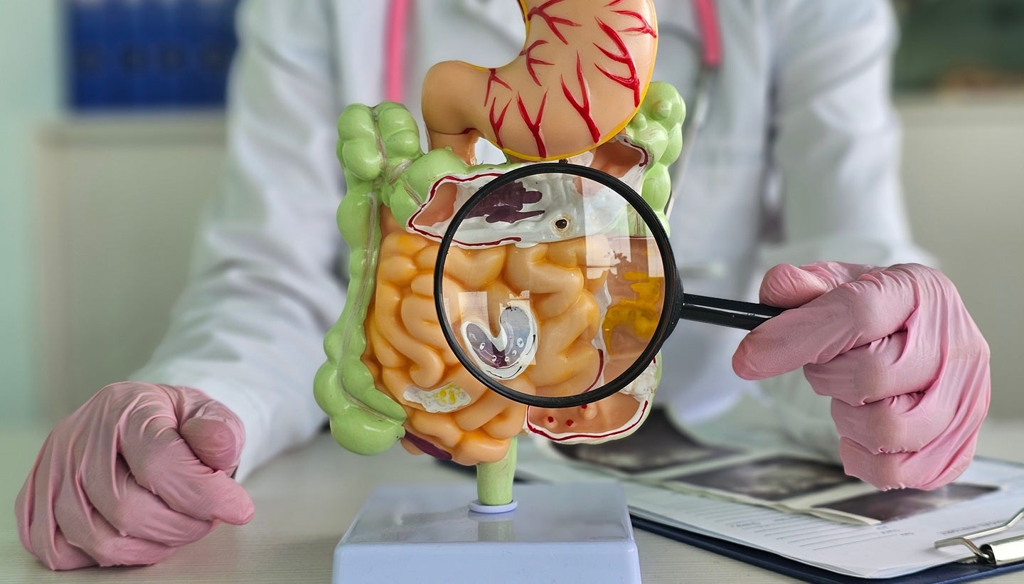 Innovent receives NMPA approval for Tabosun colon cancer treatment