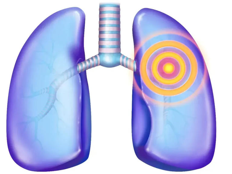 Genmab stock slips after discontinuing further development of cancer ...