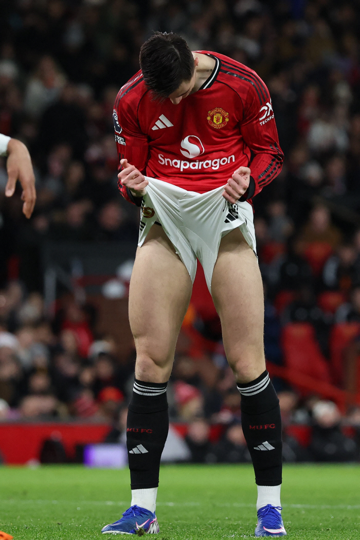 He's just a foil run, too! ST's that get smashed whenever Manchester ...