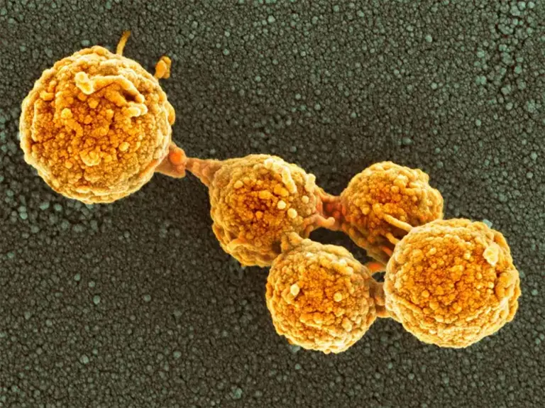 Uma microfotografia colorida, captada por um microscópio electrónico de varrimento de células Mycoplasma mycoides JCVI-syn1.0. Desenvolvida por investigadores no Instituto J. Craig Venter, a célula JCVI-syn1.0 foi a primeira célula a capaz de se auto-reproduzir controlada por um genoma sintético.
