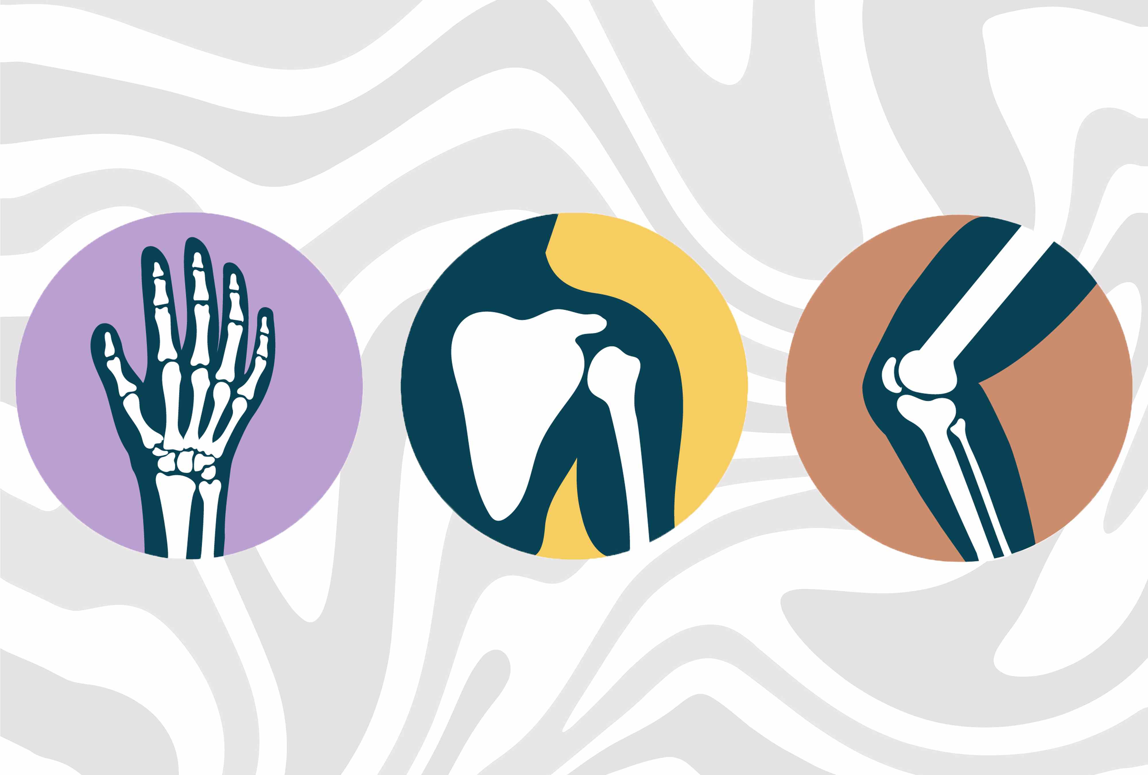 What happens to your bones when you take calcium
