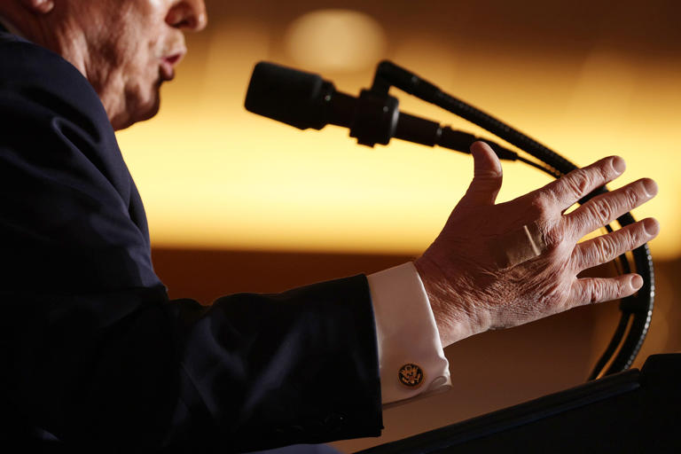 Trump explains mysterious hand bruises, bleeding in WSJ interview