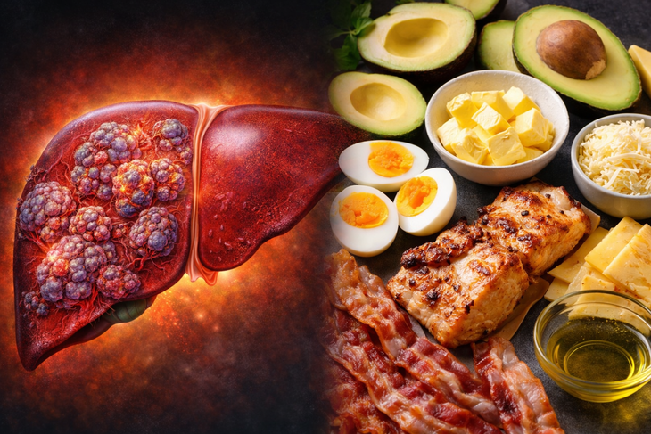 Ăn nhiều chất béo, giảm tinh bột có 'nuôi' ung thư gan?